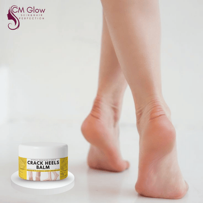 Cracked Heels Balm – Instant Heel Repair Cream | Foot Crack Cream | Dry Feet Softener | Deep Moisturizing Heel Cream